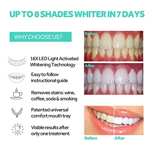 Piokikio Teeth Whitening LED Light Whitening Enhancer Light Trays...
