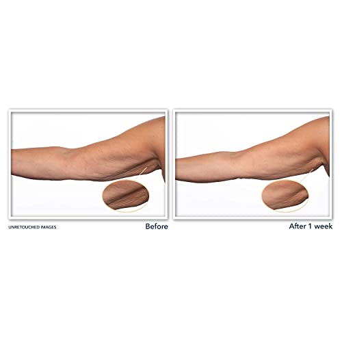 RoC Multi Correxion Crépe Repair, Targeted Treatment for Hands, E...