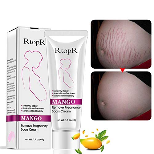 Rosymity Mango Anti-Stretch Mark Cream,with Reduces Stretch Marks...