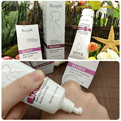 Rosymity Mango Anti-Stretch Mark Cream,with Reduces Stretch Marks...