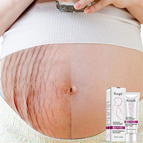 Rosymity Mango Anti-Stretch Mark Cream,with Reduces Stretch Marks...