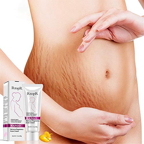 Rosymity Mango Anti-Stretch Mark Cream,with Reduces Stretch Marks...