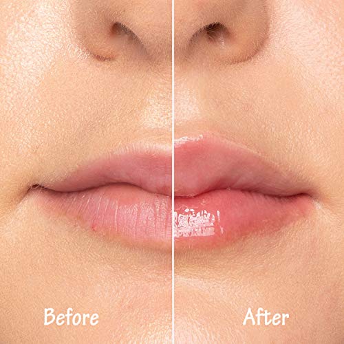 Natural Lip Plumper,Lip Plumper Set, Lip Enhancer, Lip Plumping B...