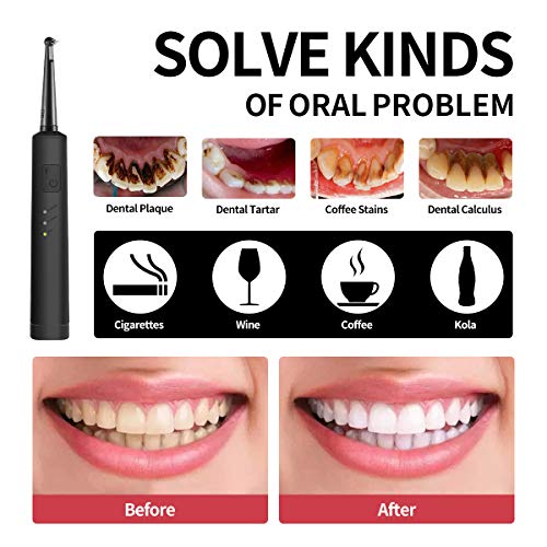 Electric Dental Calculus Remover with LED, High-Frequency Vibrati...