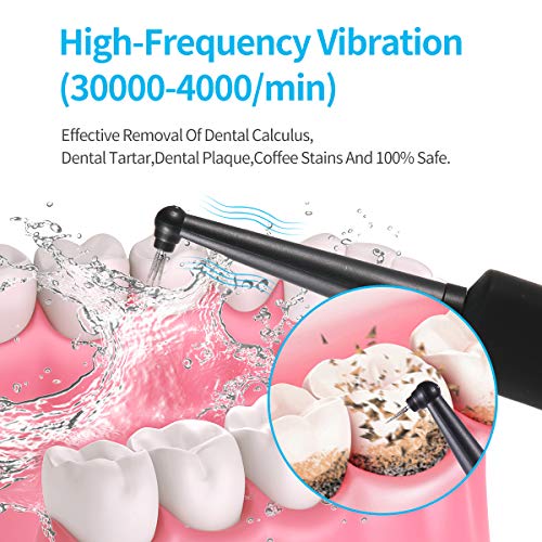 Electric Dental Calculus Remover with LED, High-Frequency Vibrati...