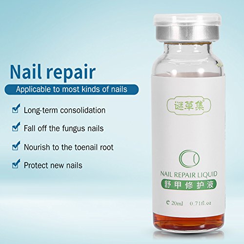 SoarUp Nail Fungus Treatment, Anti Fungus Nail Treatment Onychomy...