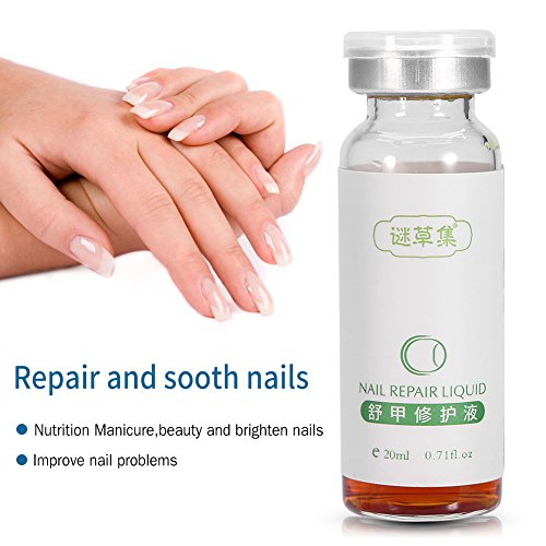 SoarUp Nail Fungus Treatment, Anti Fungus Nail Treatment Onychomy...