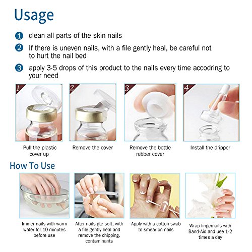 SoarUp Nail Fungus Treatment, Anti Fungus Nail Treatment Onychomy...