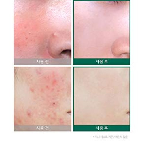 Somebymi AHA BHA PHA Miracle Serum 1.7 oz / 50ml + Cream 1.7 o...
