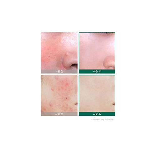 Somebymi AHA BHA PHA Miracle Serum 1.7 oz / 50ml + Cream 1.7 o...