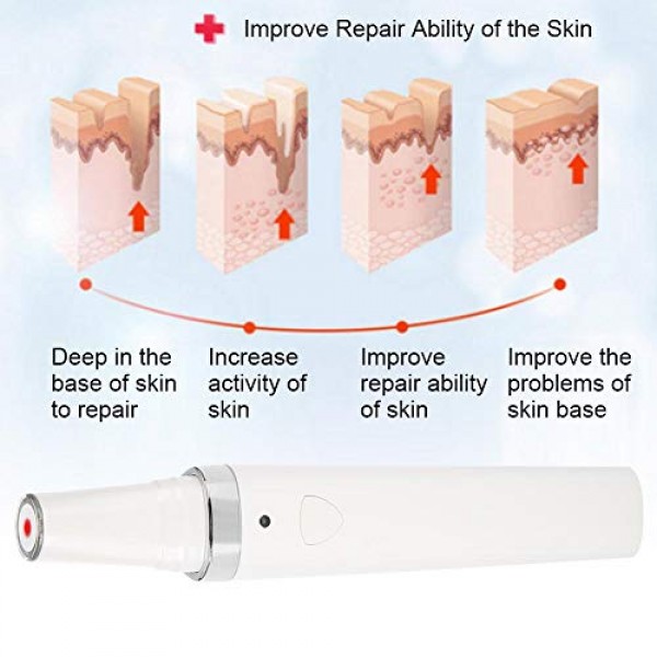 3 IN 1 Acne Removal Pen for Scar Repair Skin Rejuvenation Machine...