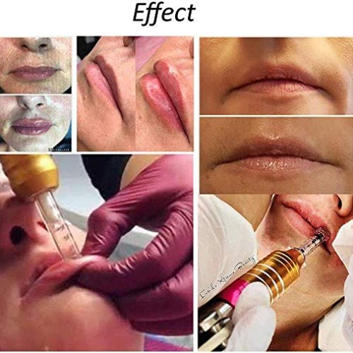 SYYSYY Hyaluron Pen,Massage Atomizer Hyaluron Pen High Pressure A...