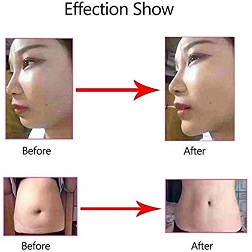 SYYSYY Hyaluron Pen,Massage Atomizer Hyaluron Pen High Pressure A...