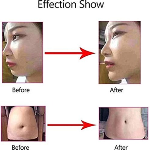 SYYSYY Hyaluron Pen,Massage Atomizer Hyaluron Pen High Pressure A...