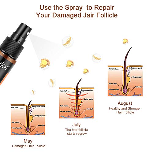 Hair Grow Spray, Anti Hair Loss, Thinning, Balding, Natural Ingre...