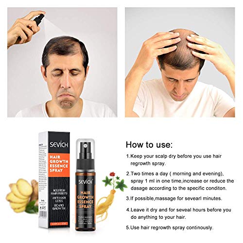 Hair Grow Spray, Anti Hair Loss, Thinning, Balding, Natural Ingre...