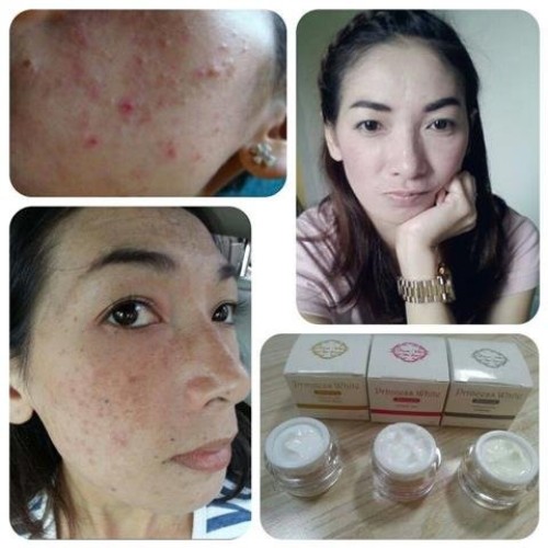Set of 3 Princess Skin Care 1.Baby Face Skin Care 2. Aura Face Sk...