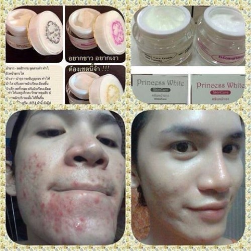 Set of 3 Princess Skin Care 1.Baby Face Skin Care 2. Aura Face Sk...