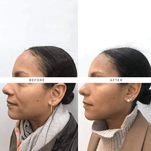 The Nue Co. - Natural Skin Filter Skincare Supplement | for Impro...