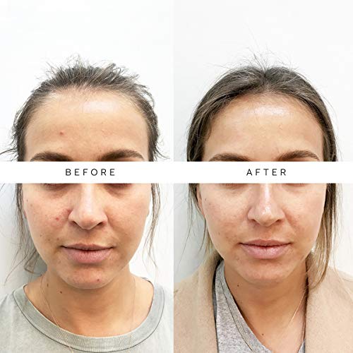 The Nue Co. - Natural Skin Filter Skincare Supplement | for Impro...