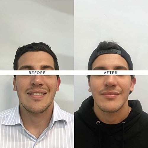 The Nue Co. - Natural Skin Filter Skincare Supplement | for Impro...