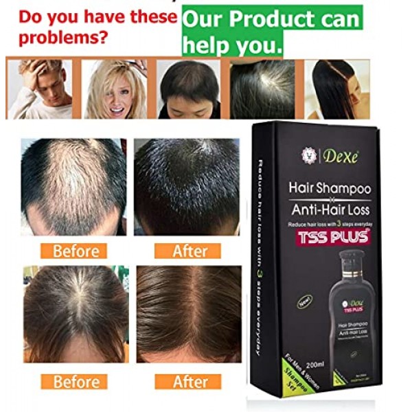 TSSPLUS DEXE 200ml Anti-Hair Loss Hair Growth Shampoo,hair loss,h...