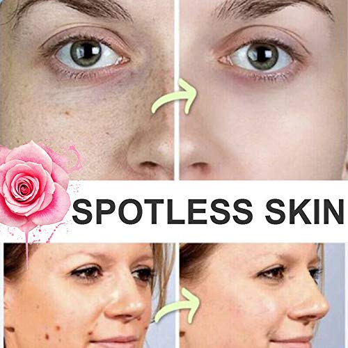 Organic Tags Solutions Serum Mole & Skin Tag Removal Solution Pai...