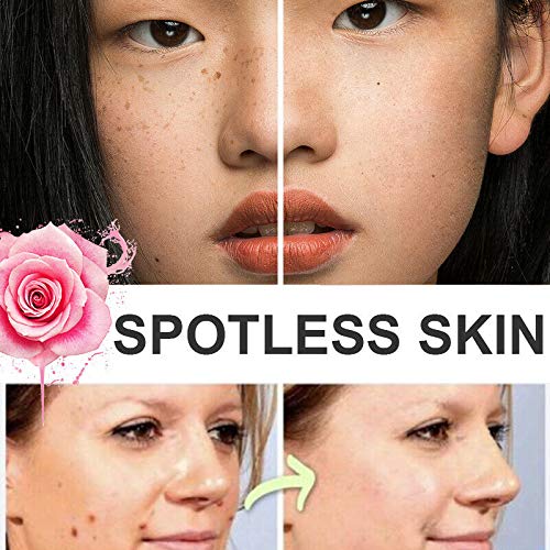 Organic Tags Solutions Serum Mole & Skin Tag Removal Solution Pai...