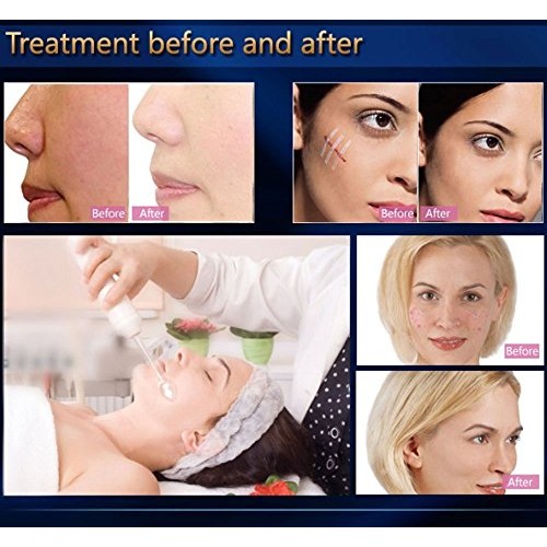 VamsLuna High Frequency Wand Machine, Portable Electrode Beauty D...