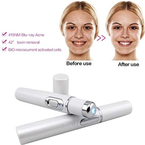 Blue Light Pen for Spider Veins,Blue-Light Acne Remove,Blue Light...