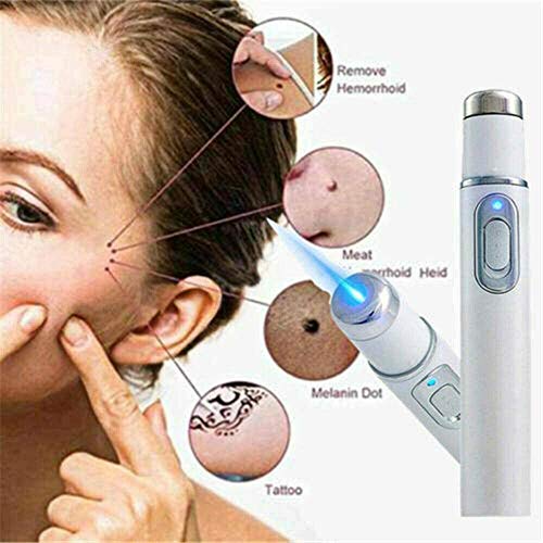 Blue Light Pen for Spider Veins,Blue-Light Acne Remove,Blue Light...