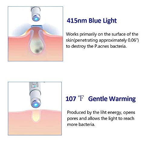 Blue Light Pen for Spider Veins,Blue-Light Acne Remove,Blue Light...