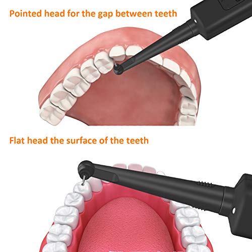 Electric Dental Calculus Remover Tooth Tartar Cleaning Teeth Tool...