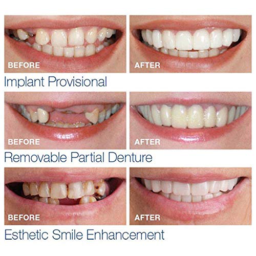 XILALU 1 Pair Simulation Teeth, Upper&Lower Temporary Smile Comfo...