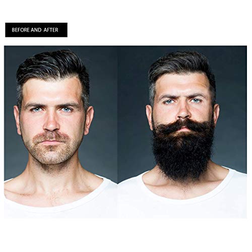 Derma Roller for Beard Growth, Beard Growth Serum, Microneedle Ro...