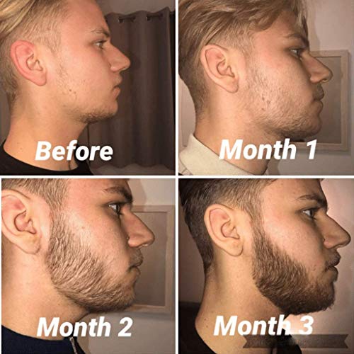 Beard Growth Kit, Derma Roller with Beard Growth Oil Serum for Me...