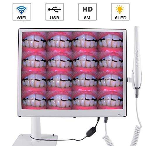 Zinnor Intraoral Camera WiFi 8 Million Pixels 17 Inches Ultrathin...