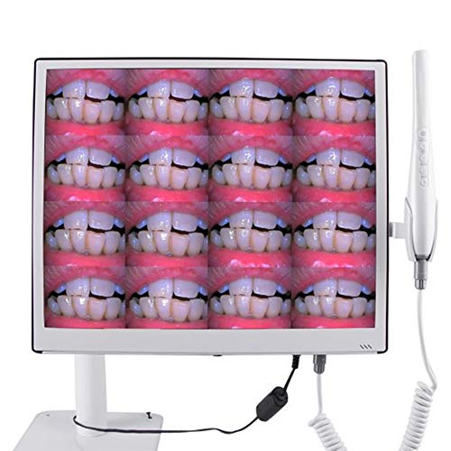 Zinnor Intraoral Camera WiFi 8 Million Pixels 17 Inches Ultrathin...